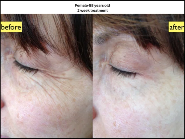 Metasomer Telomerase Natural Skin Cream From The Makers Of NANO SOMA - Image 7